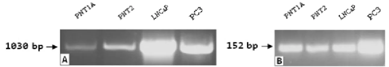 Figure 7- PCR analysis using specific primers for spanning the entire region of STEAP1  (A) and primers to 18S (B) in non-neoplastic (PNT1A and PNT2) and neoplastic (LNCaP  and PC3) human prostate cell lines
