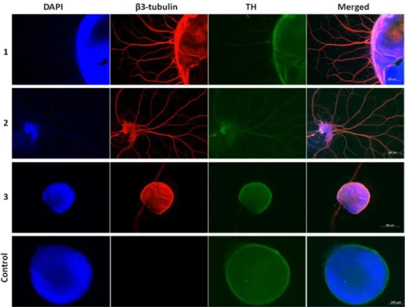 Figure  3.3  -  Characterization  of  Embryoid  Body  Differentiation  Results.  Immunofluorescence  against  β3-tubulin (red, immature/mature neuron marker) and tyrosine hydroxylase (TH, green, dopaminergic  neuron  marker)  and  staining  with  DAPI  (bl