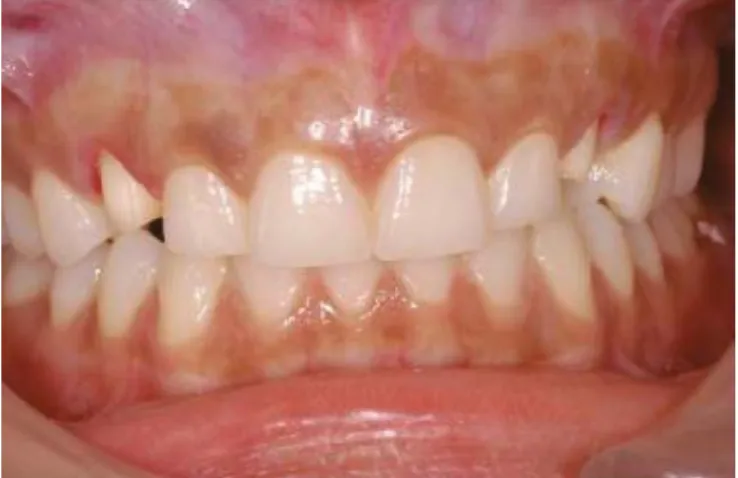 Figure 4. a-d) Clinical figures after treatment.