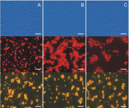 Figure 2. Three Baltic Synechococcus sp. strains: rich in PE (A);rich in PC (B) and rich in PE containing  high  contents  of  the  PEB  (C)  under  a  light  and  epifluorescence  microscope