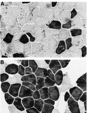 Figura  1.  Microfotografia  da  distribuição  dos  tipos  de  fibra  muscula  (escuras  tipo  II  e  claras  tipo I) em indivíduos normais (A) e com insuficiência cardíaca (B)