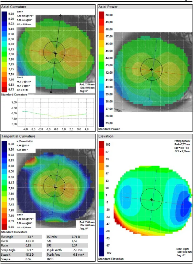 Figura 2. Registos topográficos da superfície anterior do olho esquerdo adquiridas pelo topógrafo corneal  Medmont Studio – version 4.9.0.0.