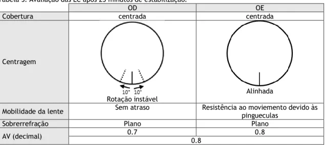 Tabela 5: Avaliação das LC após 25 minutos de estabilização. 