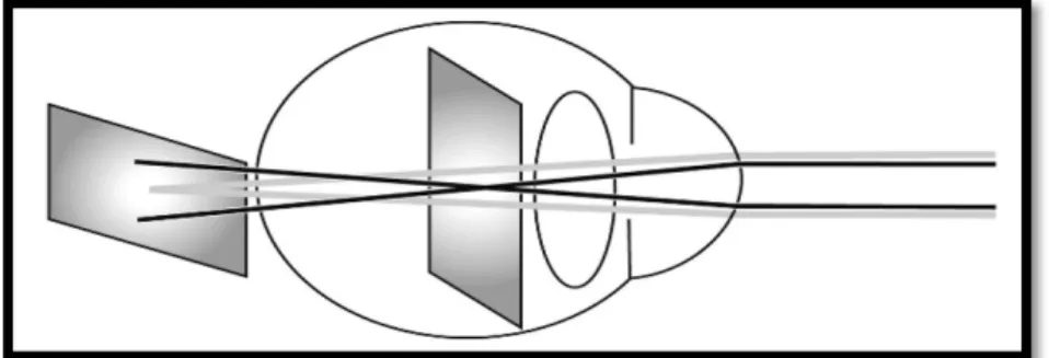 Figura 1 – Representação esquemática de um olho com astigmatismo (10). 