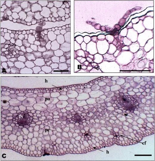 Figura  6.  Cortes  transversais  da  bainha  foliar  de  abacaxi  Pérola  evidenciando  tricoma  glandular e parte do mesofilo