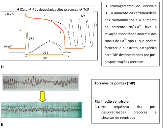 Figura  1  –  A  -  Método  “avoid-the-tail”:  o  final  da  onda  T  é  considerado  como  o  ponto  de  intersecção  da  linha  de  base  com  a  tangente  ao  declive  mais  acentuado  da  última  parte  da  onda  T;  B  –  SQTL  congénitas  e  alteraçõ