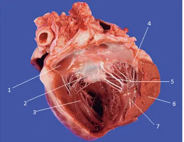 Figura 1. Tracto de entrada do ventrículo esquerdo (adaptado de Ware, 2007a). 