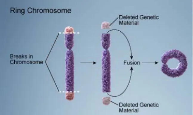 Fig. 16 - Esquema ilustrativo da formação de um cromossoma em anel http://ghr.nlm.nih.gov/handbook/illustrations/,   adapt.) 