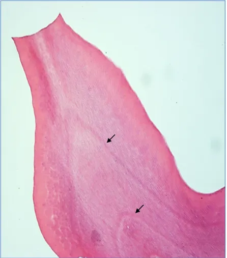 Figura 9 - Linhas incrementais da dentina (von Ebner) (setas). 