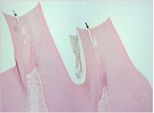 Figura 12 –  Imagem de corte histológico de um molar do rato Wistar, mostrando duas  das  cúspides