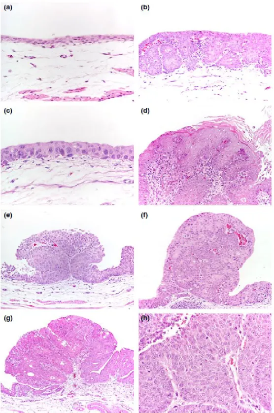 Fig.  1-  BBN-induced  rat  bladder  lesions  (H&amp;E).  a-  control  animal.  Normal  bladder  urothelium (100x)