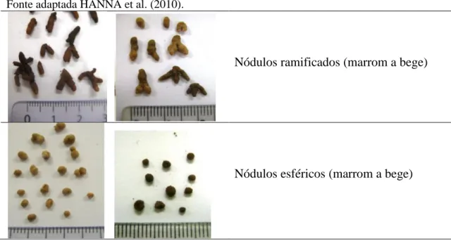 Tabela 1- Padrões utilizados para a caracterização morfológica dos nódulos de Inga ssp