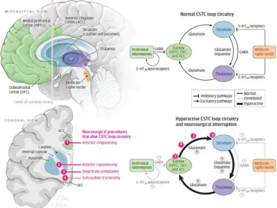 Figura 1. Anatomia e Modelos Neuroquímicos dos Circuitos CSTC Implicados na Perturbação  Obsessiva Com intervenções neuroterapêuticas associadas
