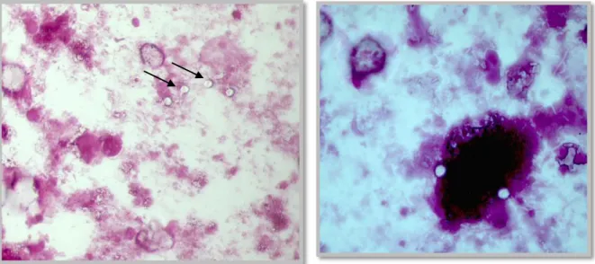 Fig.  14  and  15:  Appearance  of  Cryptosporidium  oocysts  under  the  microscope  after  carbolfuchsin staining