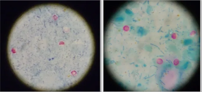 Fig. 24 and 25: Positive samples. Oocysts are highlighted in pink, in front of a greenish  background (Original pictures)
