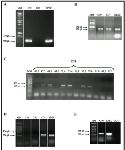 Figura  14.  Perfis  eletroforéticos  dos  produtos  de  PCR  obtidos  com  o  par  de  iniciadores  AD3 e espA REV