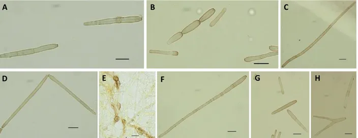 Figura 7.  Variabilidade morfológica dos conídios e clamidósporos produzidos por isolados  Corynespora  cassiicola  com  5  dias  de  incubação:    (A)  1989,  (B)  1503,  (C)  2107,  (D)  1049,  (E)   EH-2045, (F) EH-2082, (G) EH-2124, (H) EH-1720