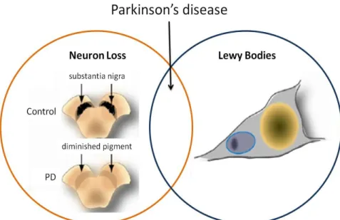 Figure  1.  Relationship  between  cell  death  and  LBs  formation  in  PD.  DA  cell  death  (orange  circle)  is  characterized  by  loss  of  neurons  in  the  SNpc  and  LBs   (blue circle) Adapted from Cookson et al