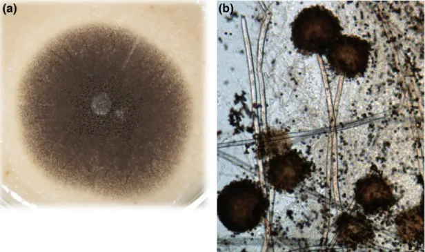 Figura 3: Fungos do gênero Aspergillus. (a): Colônia de Aspergillus niger em meio de cultura sólido BDA