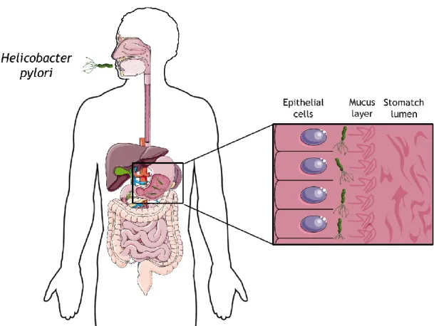 Figure  1.3:  Schematic  representation  of  the  H.  pylori  infection. The  bacterium  is  acquired  by  oral  ingestion and colonizes the region between the mucus layer (pH 5) and epithelial cells (pH 7)