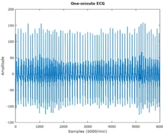 Fig. 3. Example of a sleep apnea moment in an 1 min ECG signal.