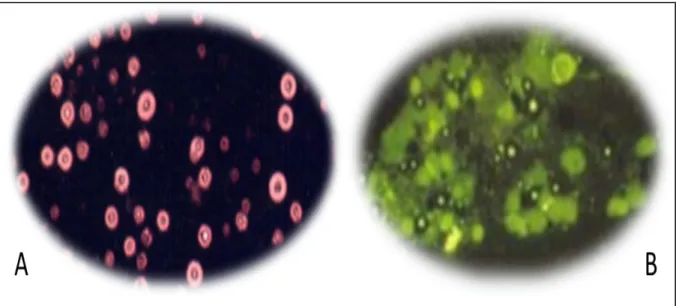 Figura 3 - Técnica de microscopia ótica para visualização de Cryptococcus spp.    