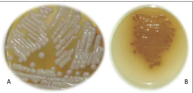 Figura 5 - Crescimento de Criptococcus spp. em ágar CGB  C. gattii (A) e C. neoformans (B) em ágar CGB 