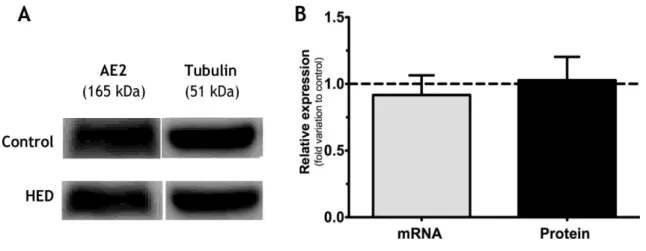 Figure 8: Effect of High Energy Diet (HED) on membrane transporter anion exchanger 2 (AE2) mRNA and  protein  levels  in  rat  testis