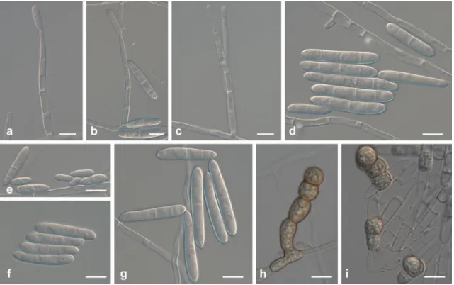 Fig. 3 Ilyonectria crassa (CBS 129083). a – c Simple conidiophores on aerial mycelium