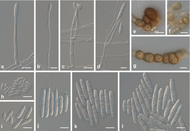 Fig. 11 Ilyonectria pseudodestructans (all from CBS 129081, except g and e from CBS117824)