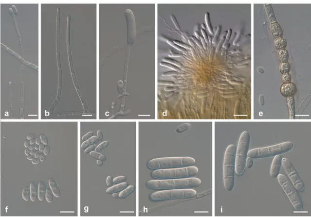 Fig. 13 Ilyonectria robusta (All from CBS 129084, except f from CBS 605.92). a – c Simple conidiophores on aerial mycelium