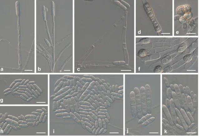 Fig. 14 Ilyonectria rufa (All from CBS 156.47, except c from CBS 120372). a – c Simple, sparsely branched conidiophores on aerial mycelium.