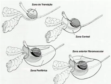 Figura 3. Anatomia zonal da próstata.[6] 