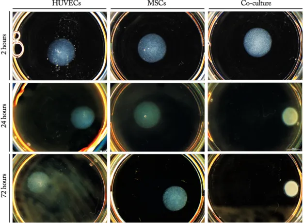 Figure   12   –   General   appearance   of   alginate   hydrogel   disks   2,   24   and   72   hours   after   cell   embedment