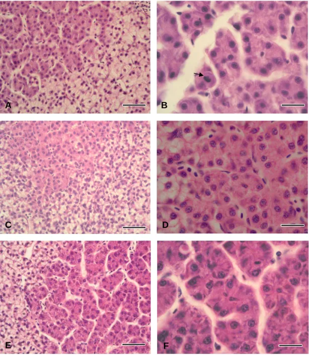 Figure 5 – Examples of the subtypes of FCA in brown trout. The basophilic FCA (A and B)  presents hepatocytes with uniformly basophilic cytoplasm (comparing with the surrounding  parenchyma), whereas the eosinophilic subtype (C and D) exhibits a uniform cy