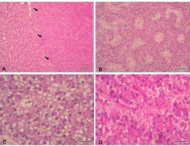 Figure  10  –  Neoplastic  lesions  in  the  dab.  The  transition  to  the  neoplasia  (arrows)  is  evident  because  the  surrounding  parenchyma  appears  compressed  (A)