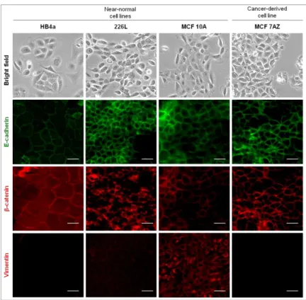 Figure  1  –Characterization  of  three  near-normal  and  one  cancer-derived  breast  cell  lines