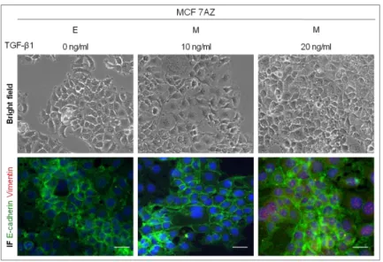 Figure  1 –  Effect of distinct  TGF-β1 concentrations on EMT induction  in MCF7AZ cell line