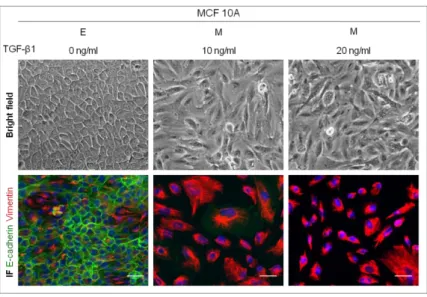 Figure  3 –  Effect of distinct  TGF-β1 concentrations on EMT induction in MCF10A cell line