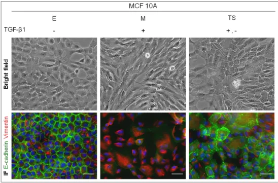 Figure 6 – EMT/MET model validation. Bright field microscopy images showing the phenotypical  alterations  and  co-immunofluorescence  for  E-cadherin  and  Vimentin  during  EMT/MET  induction  (100x)