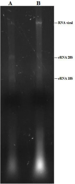 Figura 2.4:  Gel  de RNA 1% extraído a partir de amostra purificadas em colchão  de  sacarose 20%
