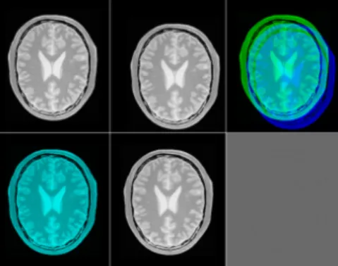 Fig. 5 shows an example of the registration of two 2D images and Fig. 6 two 3D  medical images using the intensity-based method [1]