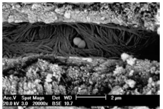 Figure 2.2 -  Bacterial biofilm formed on  the root canal wall (scanning  electron microscopy, original  magnification)).IN:  Siqaueira 