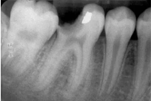 Figure 2.4  –  X-ray of 