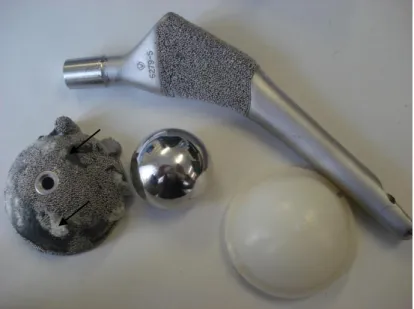 Figure 5.3 – Total Hip Prosthesis composed by a stem, a metal head, a polyethylene  acetabulum and a metallic acetabulum