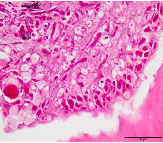 Figure 5.7 – Microscopy image with light transmission: Inflammatory process characterized  by the presence of Macrophages (M) and Lymphocytes (L), HE Staining, (40x)