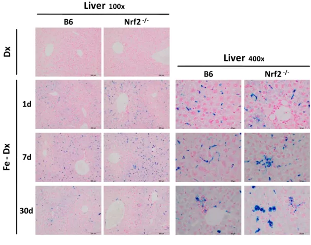 Figure 7. Perls Prussian blue staining of mouse liver sections at 100x and 400x magnification