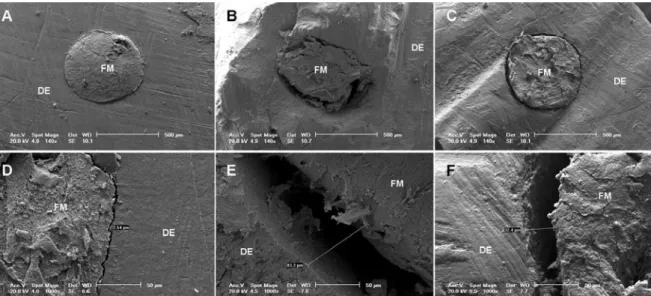 Fig. 1. Microscope images (electronic micrographs) (A, B, C, D, E and F). A) apicectomized surface from group A; B) apicectomized  surface from group B, and C) apicectomized surface from group C