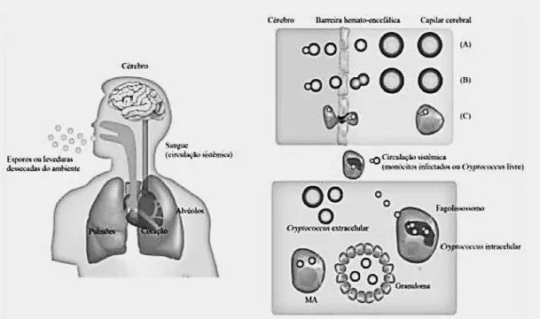 Figura 2: Modelo de disseminação de C. neoformans.  