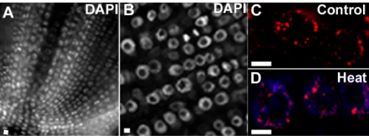 Figure 7 – Detection of DNA methylation foci in interphase nuclei by immunofluorescence staining  with 5-methylcytosine on root tissue sections of rice (cv